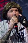 Fred Durst